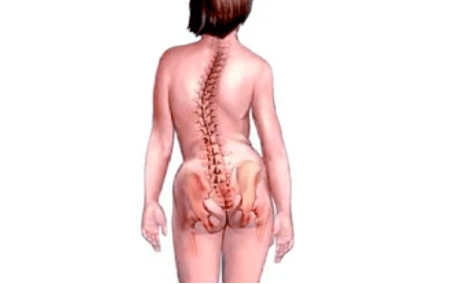Gründe für die Entwicklung einer zervikalen Osteochondrose.