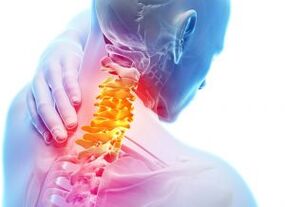 Schmerzen und Stechen im Halsbereich bei Osteochondrose dritten Grades.