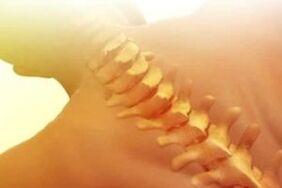 Osteochondrose, wie man behandelt